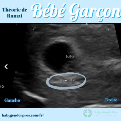 méthode ramzi fille ou garçon|méthode Ramzi pour connaître le sexe de bébé